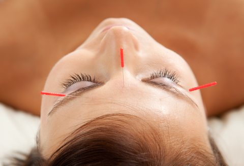Cosmetic Acupuncture, North York